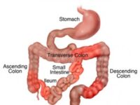 Deeltijdvasten maakt leven Crohn-patiënt dragelijker