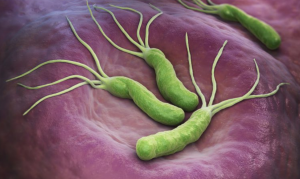 Helicobacter pylori