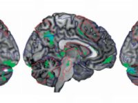 Combinatie magnesium en vitamine B6 verzacht ADHD