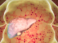 Instabiel microbioom geassocieerd met metabole aandoeningen op latere leeftijd