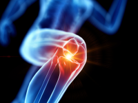 Supplement met collageen maakt versleten gewricht minder stijf en pijnlijk