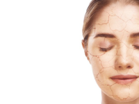 Vier voedingssupplementen werkzaam bij droge huid