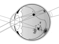 Ananas veegt gezichtsveld schoon