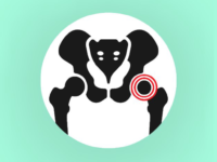 Niet-essentiële aminozuren werkzaam bij gewrichtsproblemen