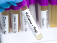 Ketonen beschermen tegen hart- en vaatziekten