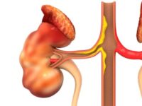 Roep arteriële kalkafzetting bij nierproblemen een halt toe met vit K2