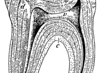 Meer vitamine D, minder gaatjes in kiezen en tanden