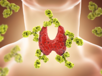 Selenium bij de ziekte van Hashimoto