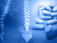 Suppletie bij gewrichtspijn door aromatase­remmers