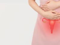 NAC verbetert hormoonprofiel bij PCOS