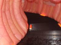 Anti-inflammatoir dieet voorkomt terugval colitis ulcerosa