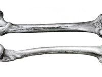 Vitamine B voor sterkere botten