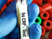 Inflammatie draagt meer bij aan hartziekten dan cholesterolniveau