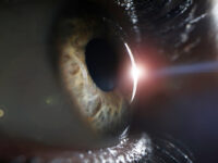 Mirtogenol, een supplement tegen glaucoom