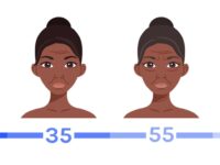 Vitamine A tegen huidveroudering