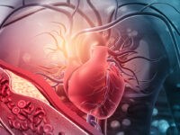 Dysbiose beïnvloedt ontstaan atherosclerose via vitamine K2 tekort