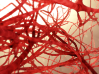 Homocysteïne remt autofagie in de vaatwand