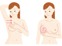 Risico op borstkanker verlagen