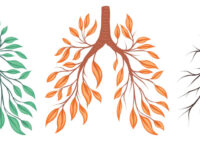 Vitamine D verbetert longfunctie bij volwassen astmatici