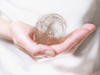 Probiotica bij alopecia