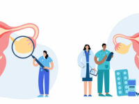 Hyaluron, chondroïtine en glucosamine voor de urinewegen