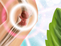 Plantaardig blijvend gunstig voor artritislijder