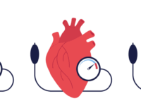 Vitamine D-suppletie gunstig voor bloeddruk bij obesitas