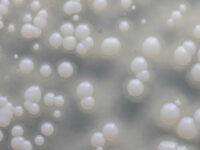 Bètaglucaan ondersteunt bij pollenallergie