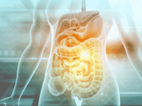 Histaminearm eten bij IBD