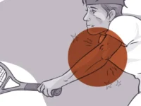 Suppletie en schokgolven bij tenniselleboog