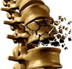 Vitamine D3 + K2 en silicium voor herstel botbreuken