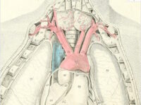Behandeling ziekte van Graves slaagt vaker met jodiumrijke voeding