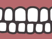 Arginine draagt mogelijk bij aan cariëspreventie