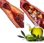 Olijfolie beschermt tegen arteriosclerose